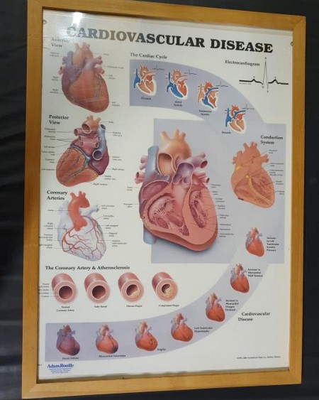 Anatomical Framed Print Cardiovascular 